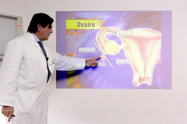 gen cáncer ovario