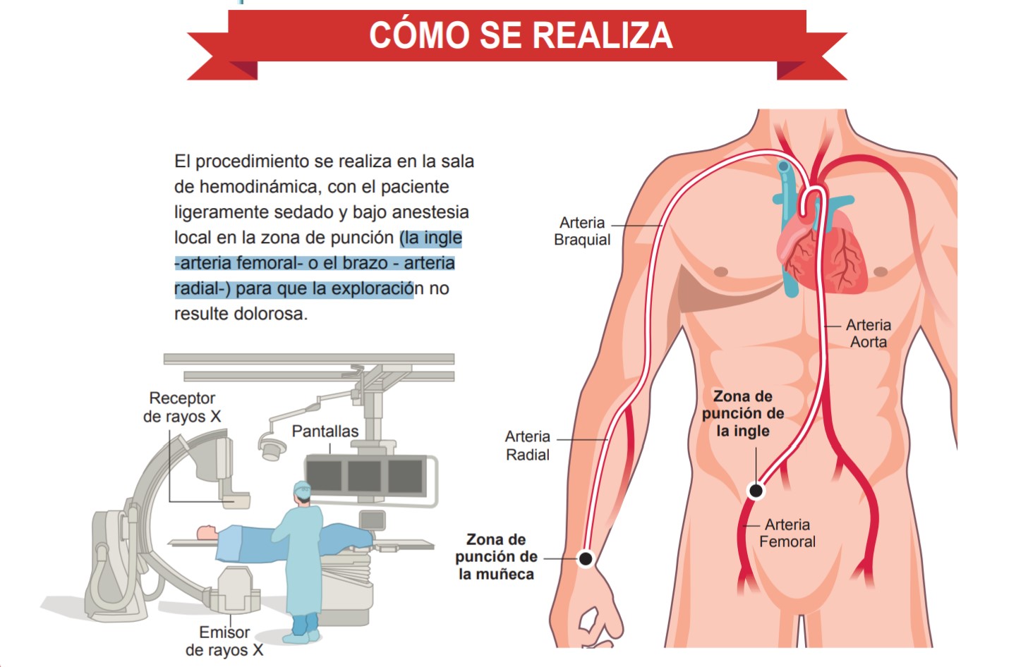 cateterismo cardiaco