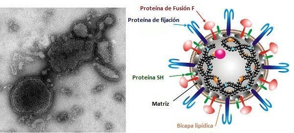 Bronquiolitis el virus de niños menores de 2 años