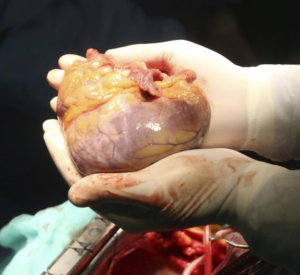 Arteria aorta: a autopista principal de la sangre en tu cuerpo