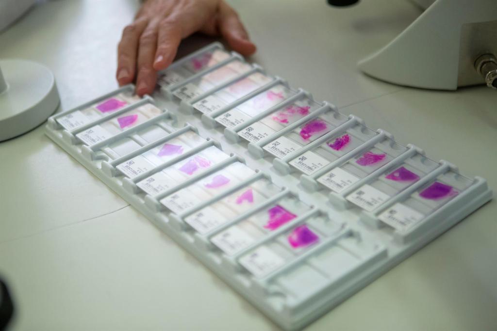 ¿Qué es el sarcoma de kaposi? EFE/ Enric Fontcuberta