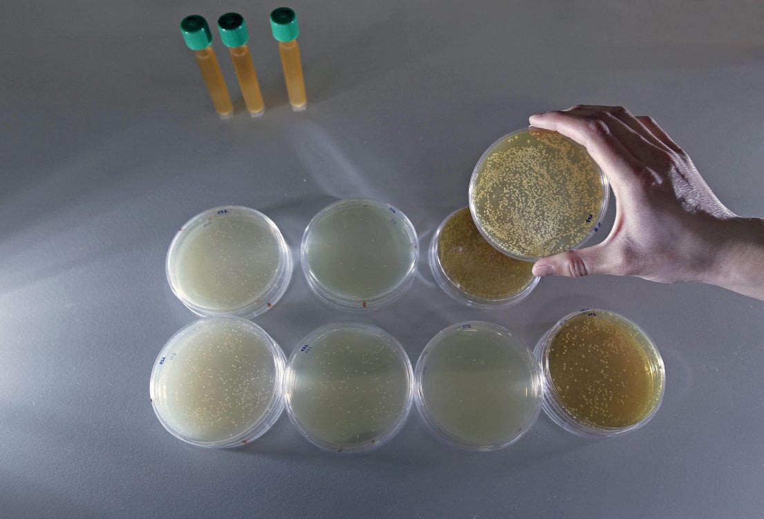 prebióticos y probióticos