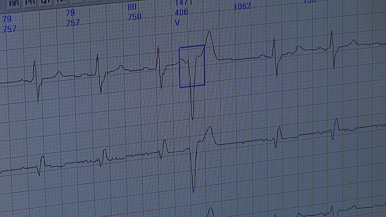 Holter