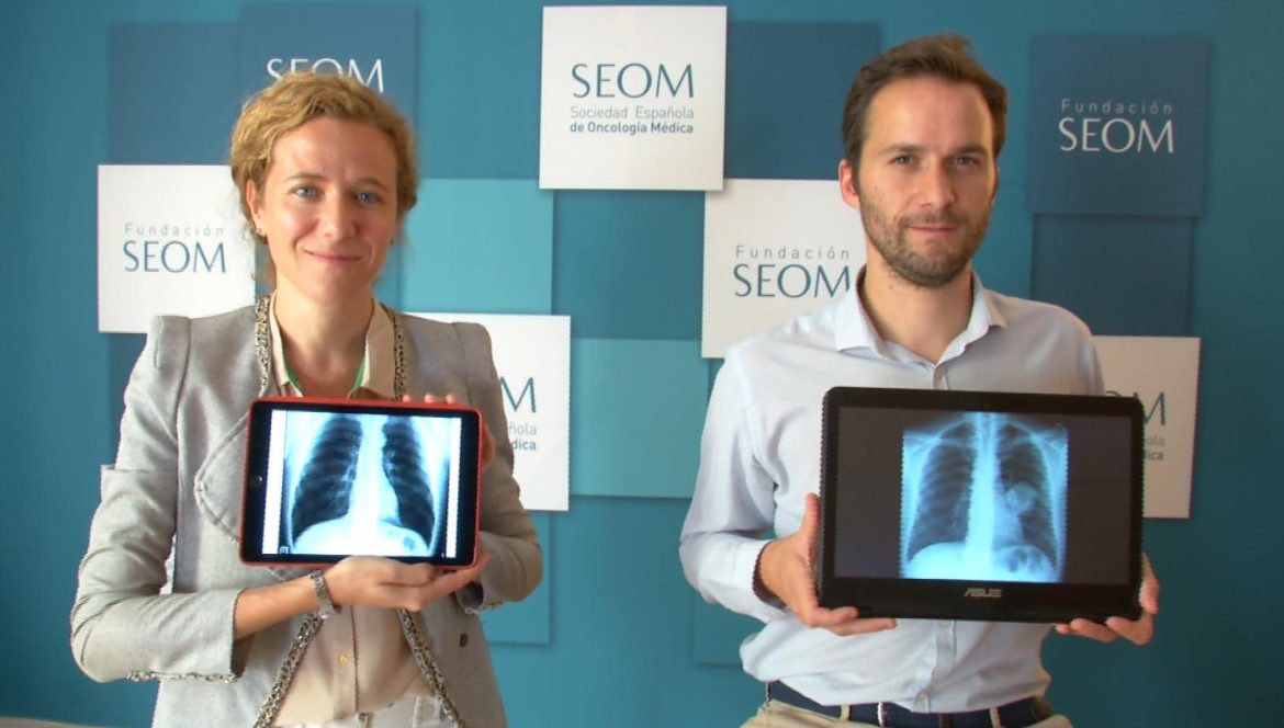 Radiografía de unos pulmones sanos