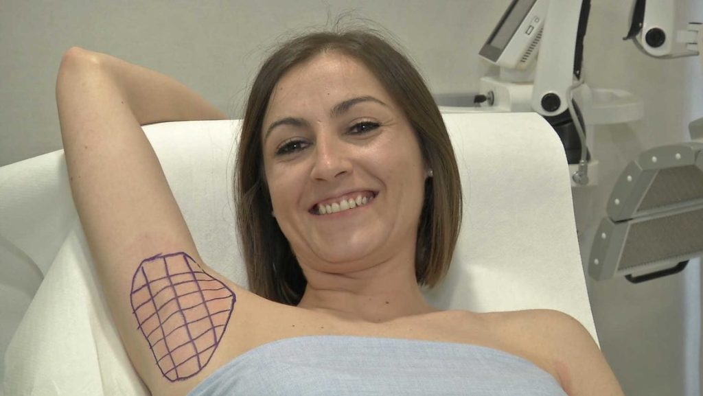 La solución a la hiperhidrosis de Macarena. La paciente en la mesa camilla durante la intervención médica.