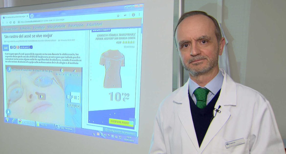 Rostro femenino con acné profundo.