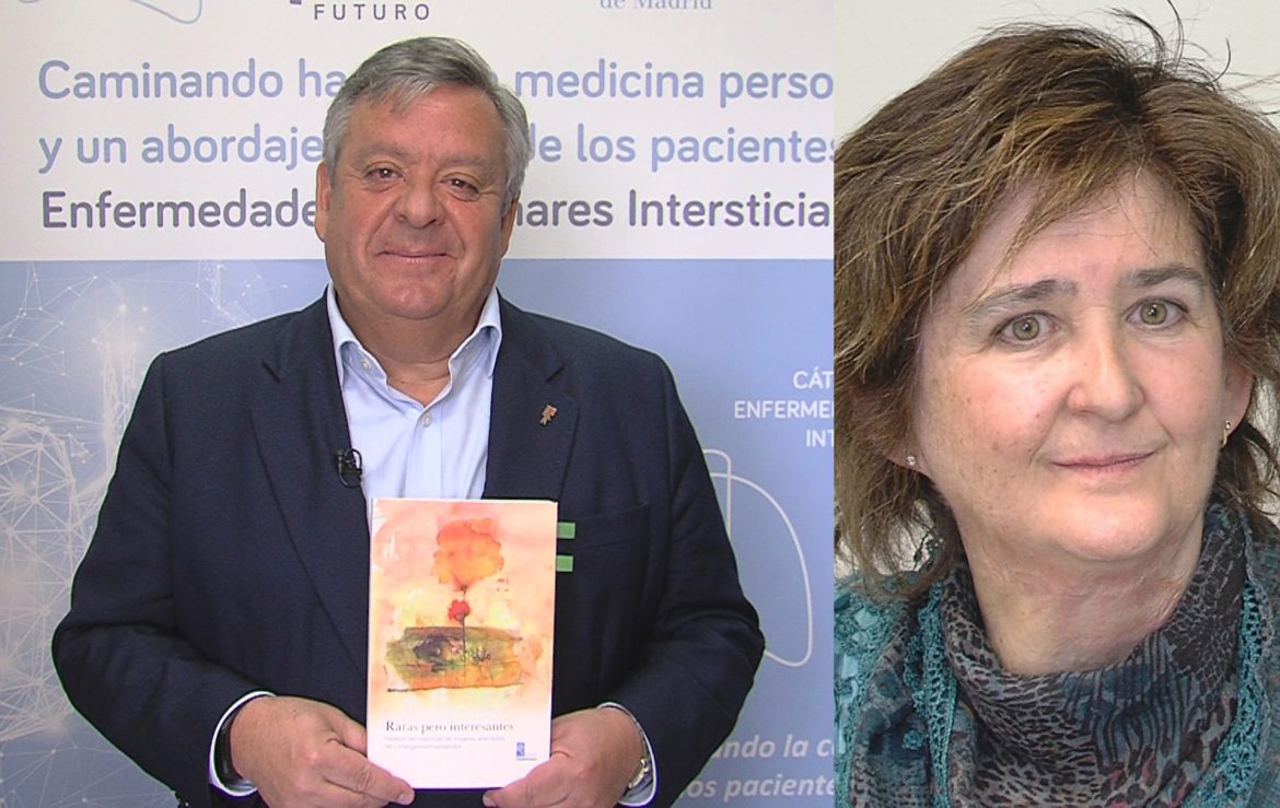 Bullas, agujeritos negros, que se forman en los lóbulos pulmonares.