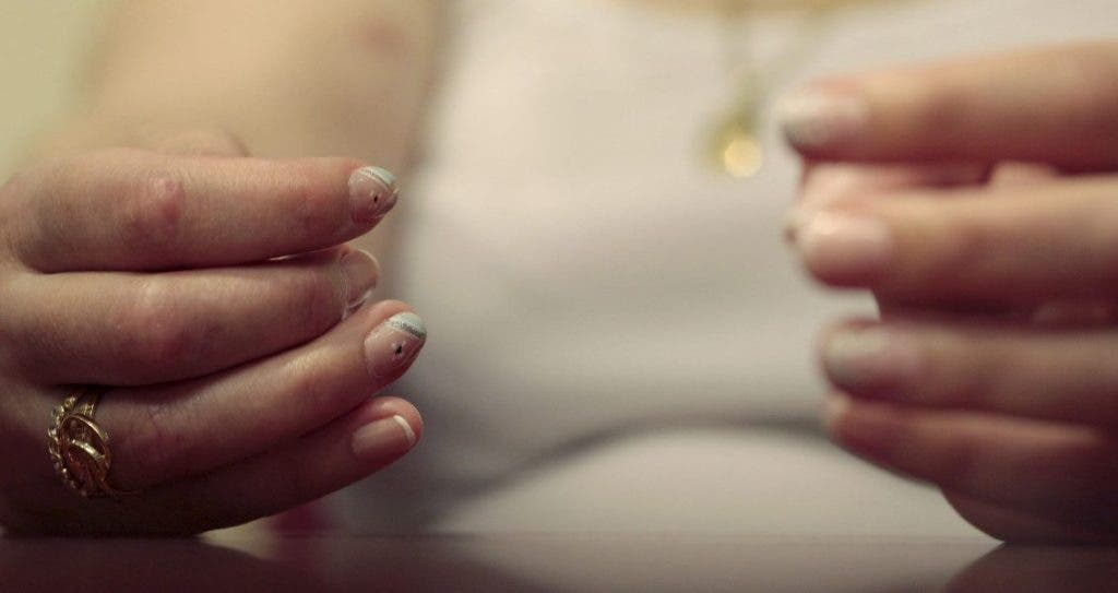 enfermedades reumáticas