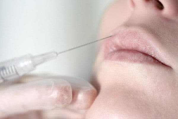 Vótox