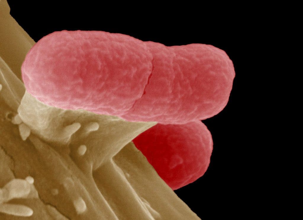 Archivofacilitada por el Centro de Investigación de Infecciones Helmhotz de una imagen tomada mediante un telescopio electrónica una bacteria EHEC, una cepa de la bacteria Escherichia coli de alta resistencia a los antibióticos, en Braunschweig (Alemania)