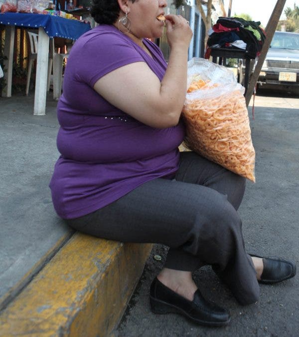 Obesidad