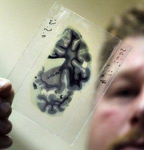 Cerebro