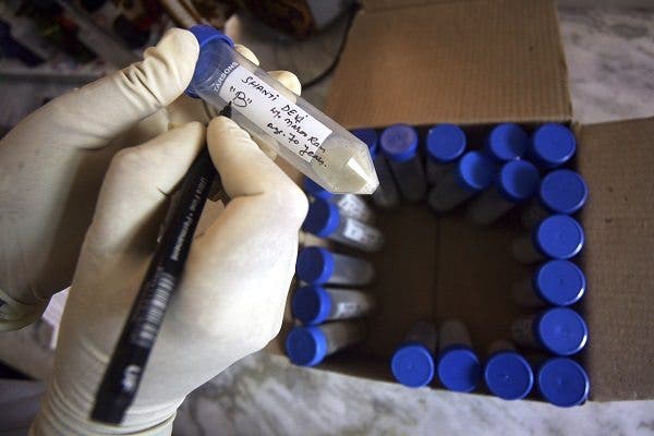 Un trabajador sanitario recoge una muestra de un paciente de tuberculosis en Jammu (India) . Efesalud.com