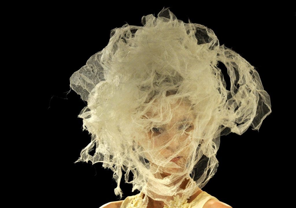 migraña crónica
