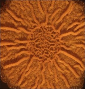 bacterias 