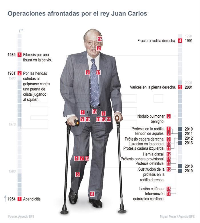 bypass rey