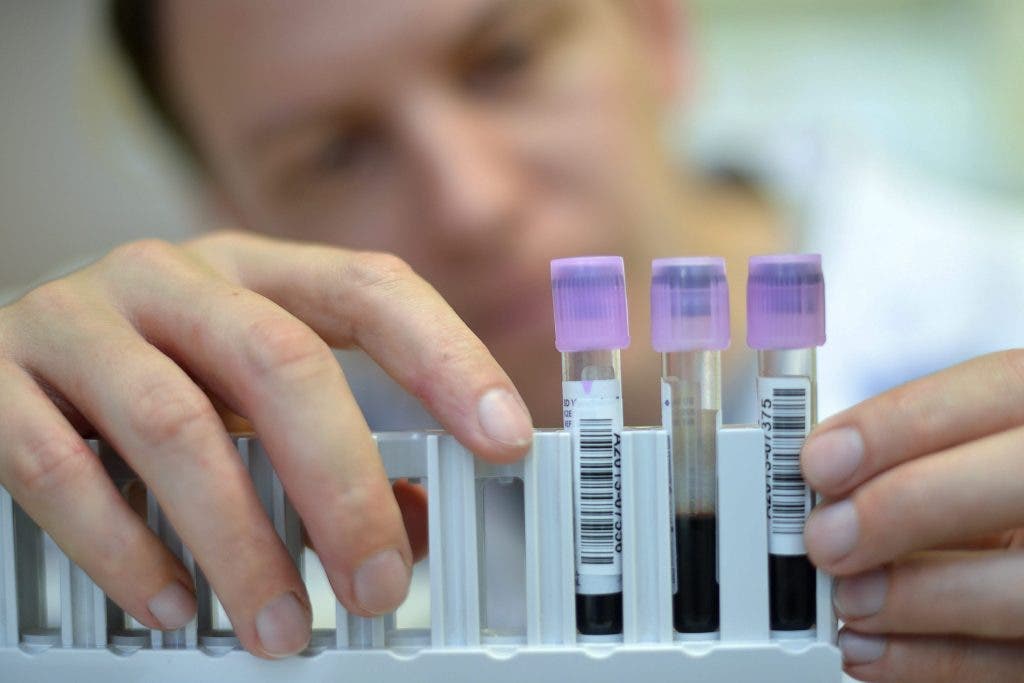 cáncer hematológico COVID19