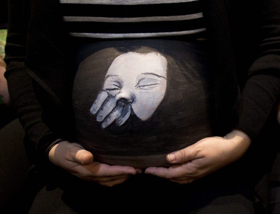 alcoholismo fetal