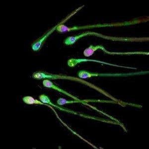 fertilidad y natalidad