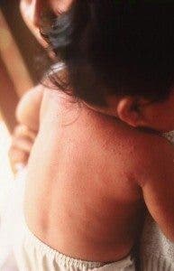 Espalda de un bebé