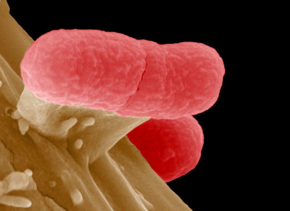 microplásticos