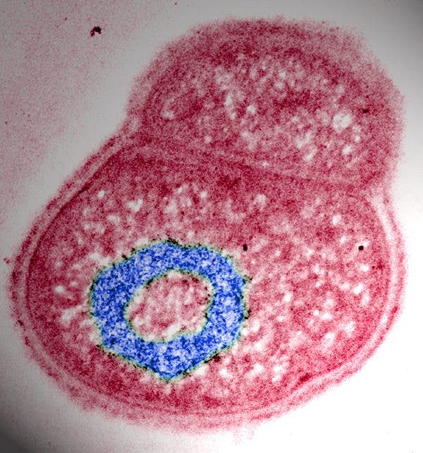BACTERIA DEINOCOCCUS RADIODURANS QUE PUEDE RESISTIR UNA RADIACION 1.000 VECES SUPERIOR AL NIVEL LETAL PARA LAS DEMAS FORMAS DE VIDA