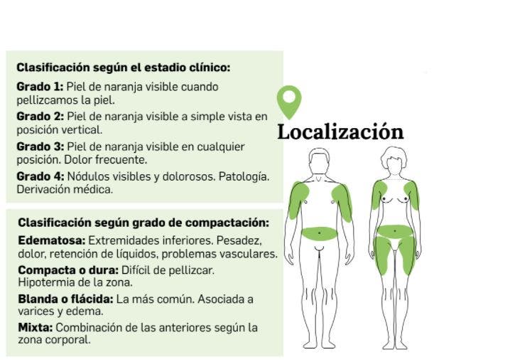 Localización de la celulitis y sus problemáticas