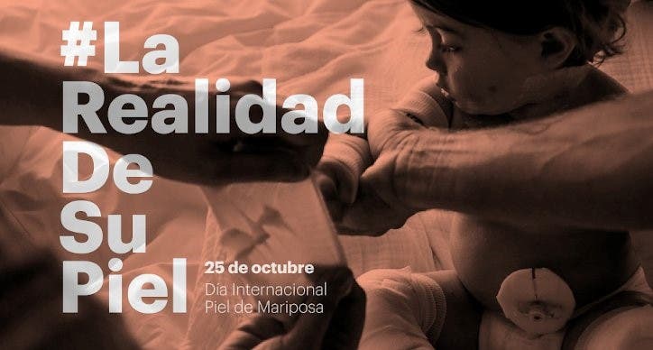 piel de mariposa