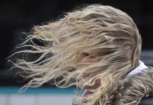 alopecia
