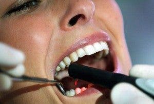 Un dentista muestra cómo gracias a la ayuda del rayo láser detecta las caries que se camuflan entre los dientes