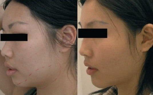 Por un rostro más estilizado