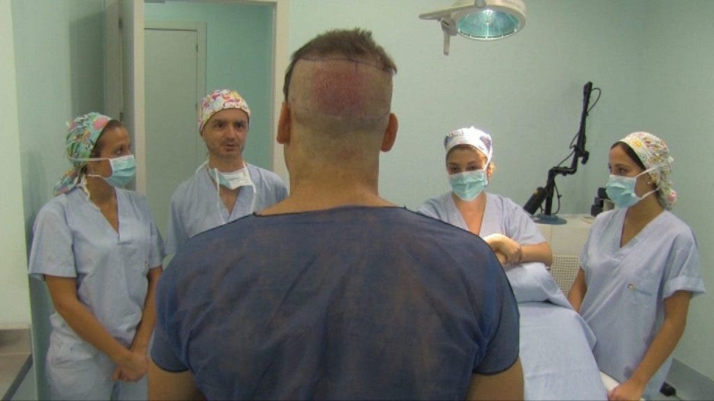 El equipo del Dr. López Bran informa al paciente Alberto A.M., de espaldas y con la nuca rasurada, de los detalles del trasplante de los folículos capilares en su zona receptora-efe