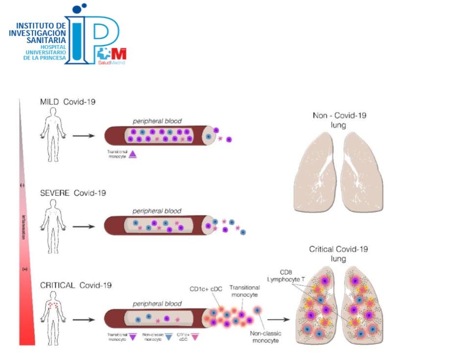 células inmunitarias COVID-19