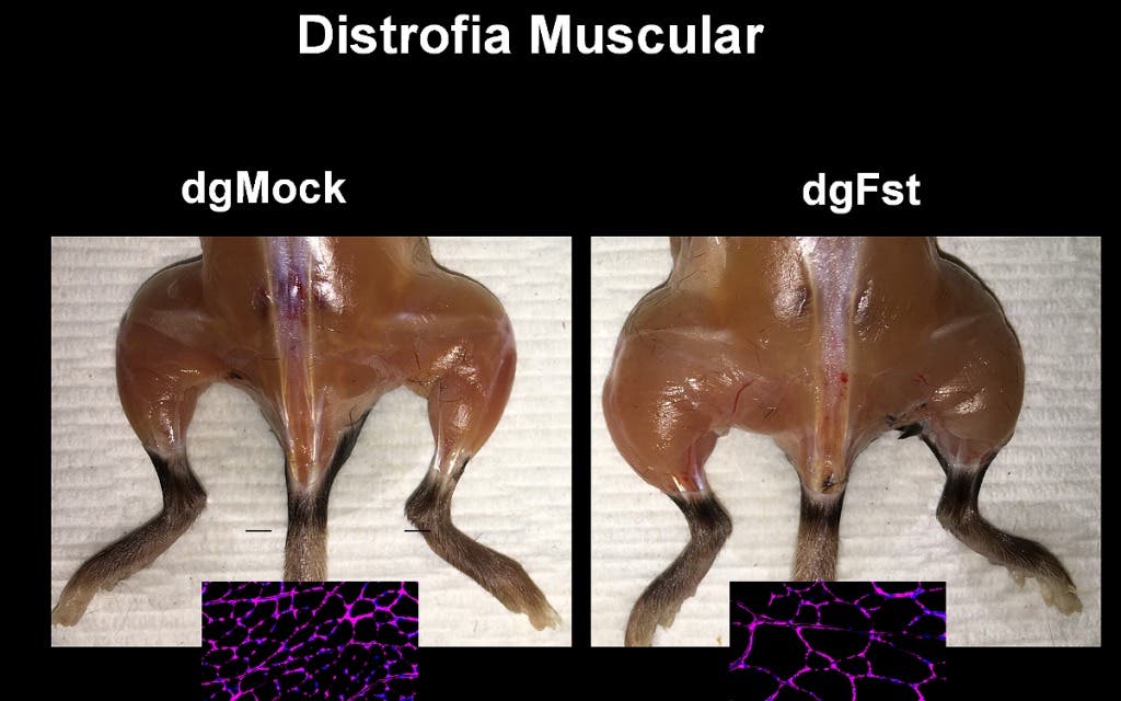 Investigación sobre distrofia muscular