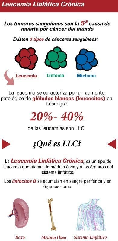 infografía
