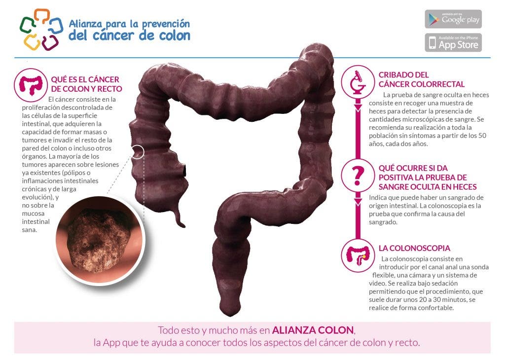 cáncer de colon