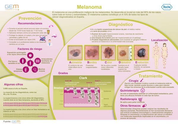 melanoma