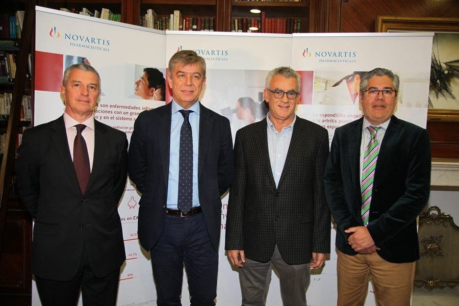 espondilitis anquilosante tratamiento