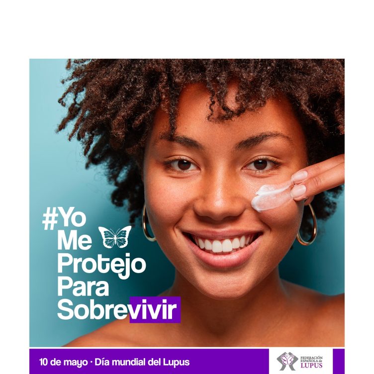 Lupus que es
