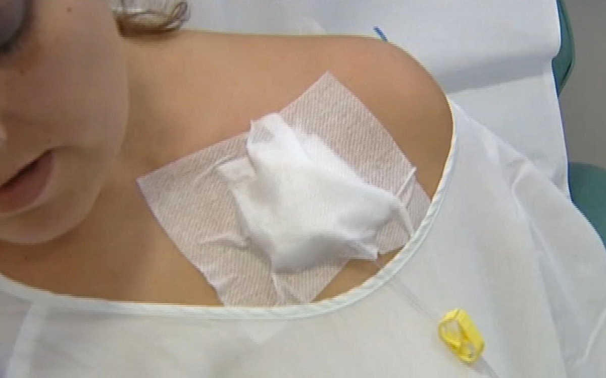 Paciente que recibe quimioterapia