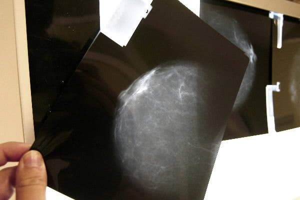 Radiografia