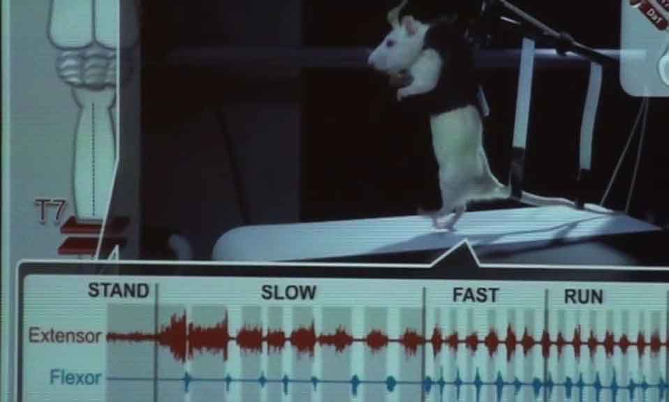 Investigación médula espinal