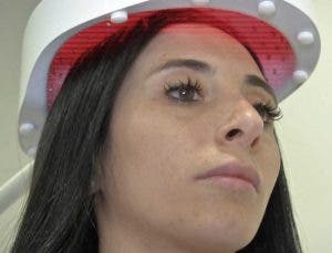 Dispositivo de rayo láser capilar actuando sobre el cuero cabelludo y el pelo.