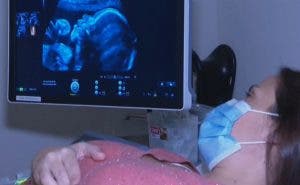 Una futura mamá observa a su bebé en la pantalla durante una ecografía.