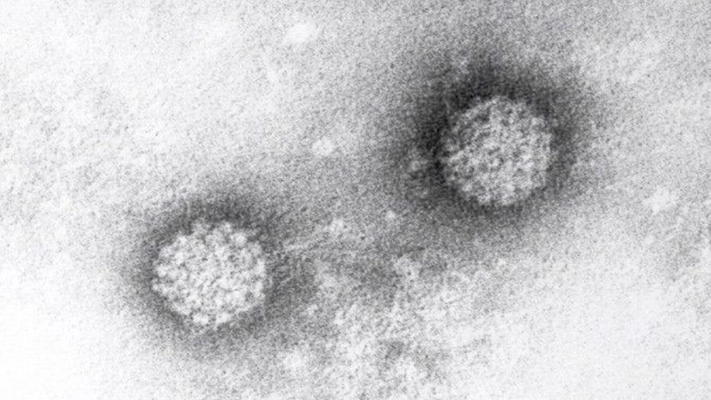 Virus del papiloma humano