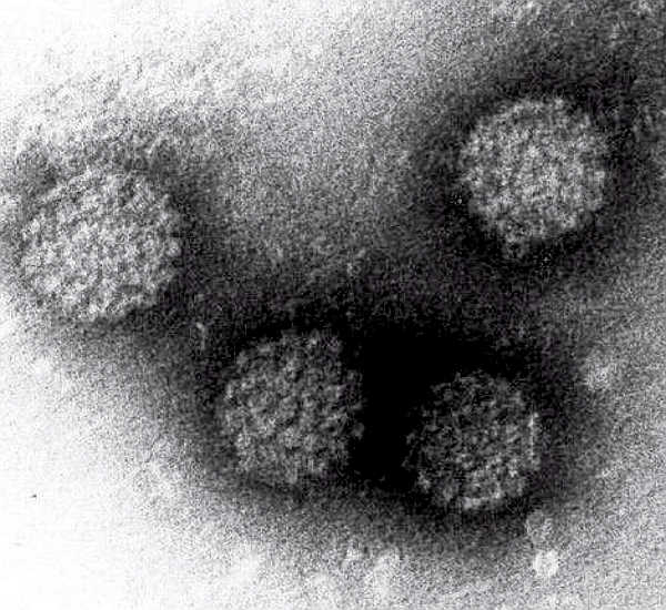 Fotografía del virus del papiloma.