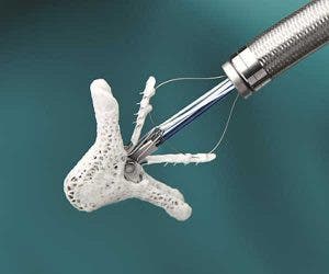 Mitraclip de los Laboratorios Abbott.