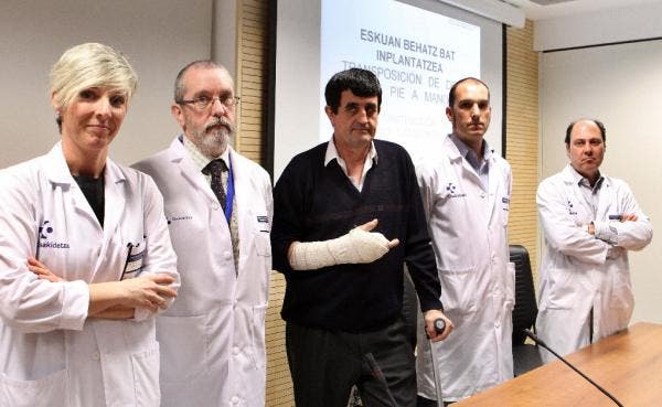 Implantan el dedo del pie en una mano