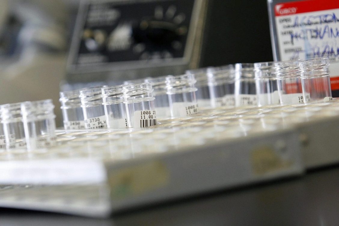 resistencia antibióticos