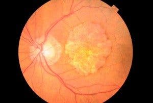 salud visual